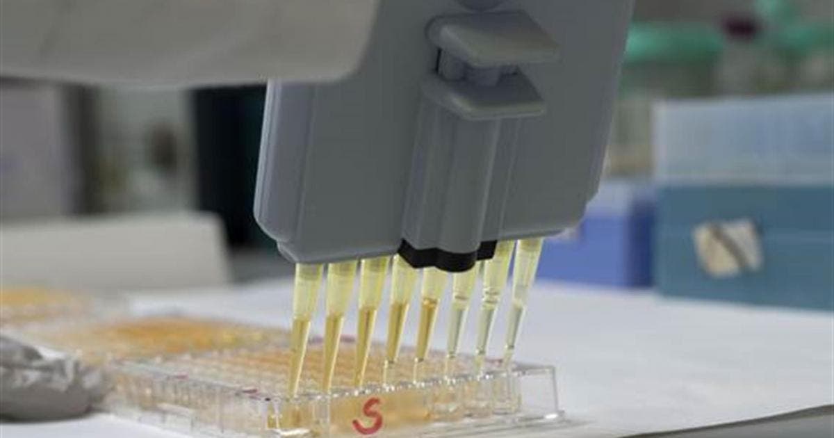 Revelan una nueva vulnerabilidad del VIH que podría ser objeto de