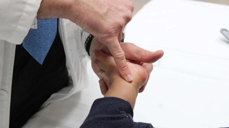 sarampion caso importado AICM CDMX