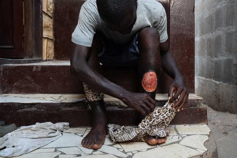 'Kush', la droga sintética que convierte en 'zombis' a jóvenes en Sierra Leona (EFE)