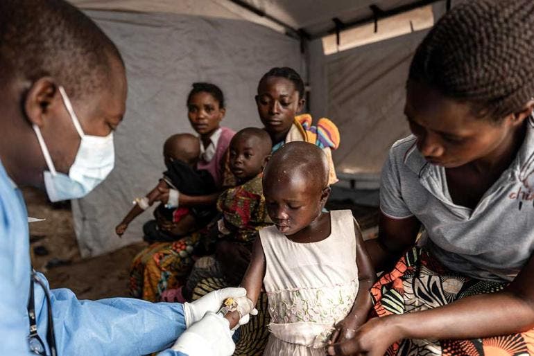 Así afecta la piel el mpox o viruela del mono que suma 643 muertes en África (EFE)