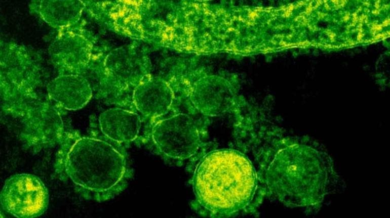 Florida alerta del aumento de la mortífera 'bacteria carnívora' a causa de ‘Helene’