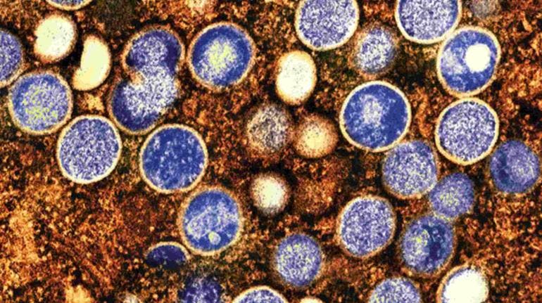 OMS confía en detener el brote de mpox en África, pero solicita más fondos
