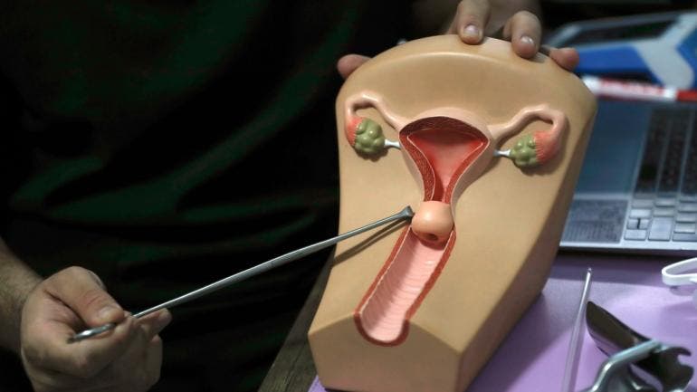 repuntan abortos Jalisco