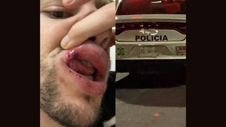 Denuncia de agresión policial en BJ: Alex Déleon relata altercado en avenida Universidad