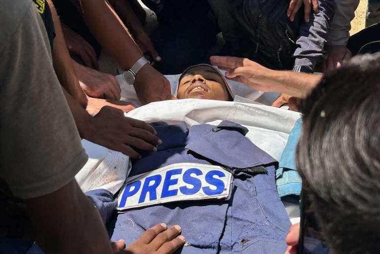 Bombardeo en Hospital Nasser en Gaza deja 5 periodistas muertos (Fotos EFE)