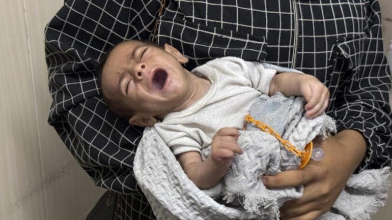 un tercio ninos Gaza sufren desnutricion moriran ONU