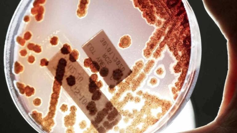 Bacterias 