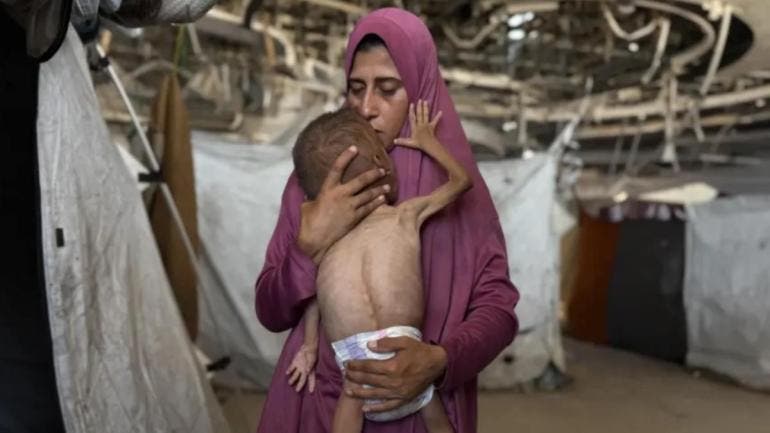 Desnutrición infantil 