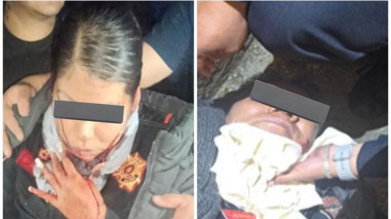 La corporación informó que la oficial y sus familiares recibirán apoyo legal y psicológico por parte de la Unidad Especializada de Género mientras avanzan las investigaciones.