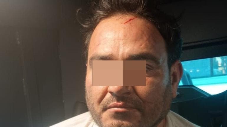 El Botox se reunio Bernardo Bravo.jpg