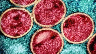 África registra más de mil muertes por viruela del mono 