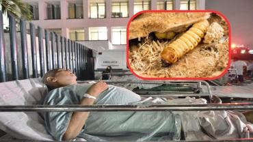 Ssa confirma primer caso humano de miasis por gusano barrenador en México