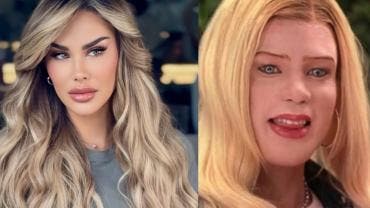 Ninel Conde comparte detalles de su cirugía para cambiar el color de sus ojos a verde olivo