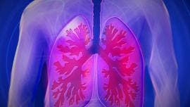 cancer pulmon OMS