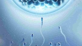 espermatozoides ultrasonidos