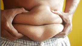 Obesidad