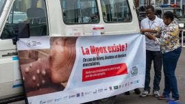 Mpox sigue fuera de control en África; Sierra Leona causa preocupación
