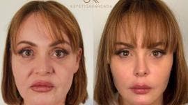 De polémica en reality a rejuvenecimiento total: Gaby Spanic muestra su nuevo rostro