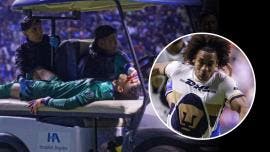 Lesión de Kevin Mier