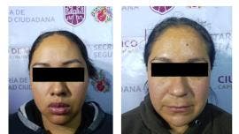 detienen dos mujeres Desarrollo Urbano Quetzalcoatl.jpg