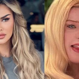 Ninel Conde comparte detalles de su cirugía para cambiar el color de sus ojos a verde olivo