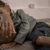 Más de 5 mil niños en Gaza padecen desnutrición aguda en mayo, alerta ONU