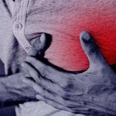 Infartos