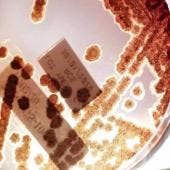 Bacterias 