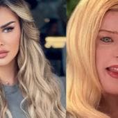 Ninel Conde comparte detalles de su cirugía para cambiar el color de sus ojos a verde olivo