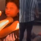 Niño es atacado en Mexicali 