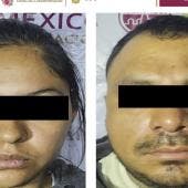 decomisan mil dosis drogas operativos tres alcaldias CDMX.jpg