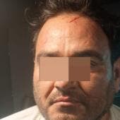 El Botox se reunio Bernardo Bravo.jpg