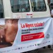 Mpox sigue fuera de control en África; Sierra Leona causa preocupación