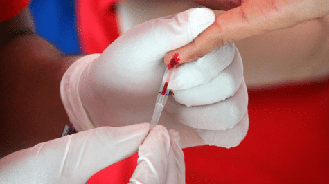 IMSS pide a pacientes con VIH que estén atentos a cambios de tratamiento 