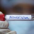 Suecia reporta primer caso de viruela del mono fuera de África