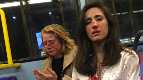 Pareja lesbiana es atacada por grupo de hombres en Londres