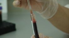 blood-ge6ab6c7f0_640.jpg