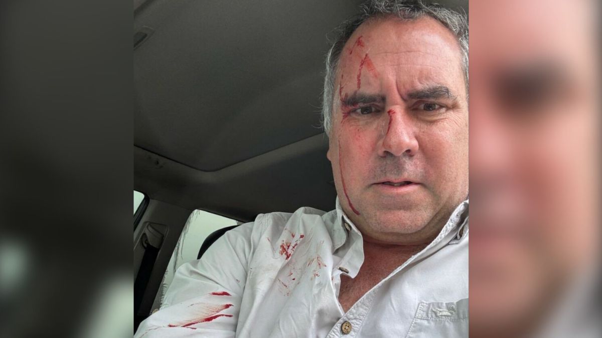 FOTOS | Candidato presidencial de Perú, Rafael Belaúnde Llosa, sobrevive a atentado