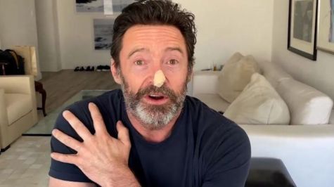 Hugh Jackman se somete a dos nuevas biopsias ante el riesgo de cáncer de piel