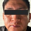 Un hombre fue vinculado a proceso por feminicidio agravado tras presuntamente disparar contra su pareja en la alcaldía Venustiano Carranza. FGJCDMX