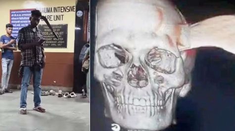 Hombre de la india entra al hospital en india con un machete en la cabeza ! Foto de @manish12345jha e India media