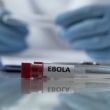 OMS espera que en dos meses haya vacunas para contener el actual brote de ébola (Pexels) OMS espera que en dos meses haya vacunas para contener el actual brote de ébola (Pexels)