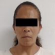 Lizeth Yuridia, alias “La Chofis”, fue detenida nuevamente en la colonia Morelos con dosis de aparente droga, informó la SSC. 