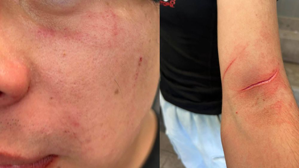 Jesús presentó lesiones en el brazo y el rostro Jesús presentó lesiones en el brazo y el rostro